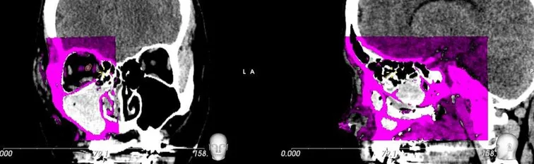 RETINA-Nova software - Mirroring