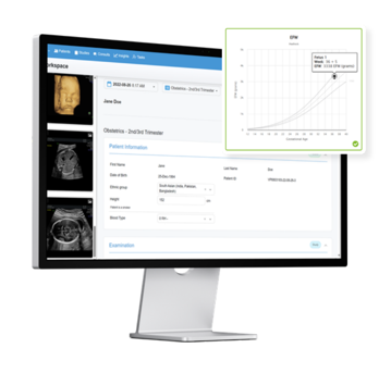 Tricefy OB and MFM reporting workspace