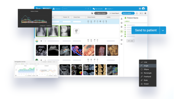 Tricefy connected imaging workspace overview